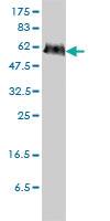 Anti-PGM3 Mouse Monoclonal Antibody [clone: 1E2-1B12]