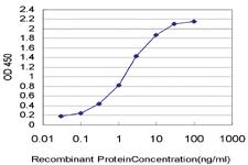 Anti-SMC1A Mouse Monoclonal Antibody [clone: 1B9]