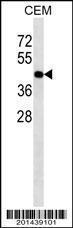 Anti-ACTA1 Mouse Monoclonal Antibody [clone: 337CT30.10.1]