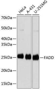 Western blot analysis of extracts of various cell lines, using Anti-FADD Antibody [ARC0415] (A306745) at 1:1,000 dilution. The secondary antibody was Goat Anti-Rabbit IgG H&L Antibody (HRP) at 1:10,000 dilution.