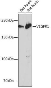 Western blot analysis of extracts of various cell lines, using Anti-VEGF Receptor 1 Antibody [ARC0363] (A307992) at 1:1,000 dilution