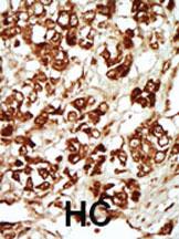 Anti-MLKLAK Rabbit Polyclonal Antibody