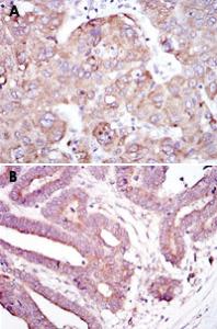 Anti-RBP4 Mouse Monoclonal Antibody [clone: 4C2]