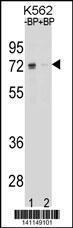 Anti-ESR1 isoform1 Rabbit Polyclonal Antibody (AP (Alkaline Phosphatase))