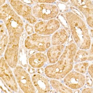 Immunohistochemistry analysis of paraffin-embedded rat kidney using Anti-HPS2 Antibody (A12057) at a dilution of 1:100 (40x lens). Perform high pressure antigen retrieval with 10 mM citrate buffer pH 6.0 before commencing with IHC staining protocol