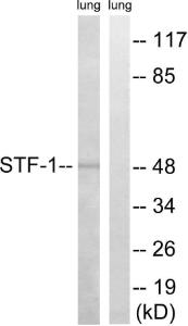 Anti-Steroidogenic Factor 1 Rabbit Polyclonal Antibody