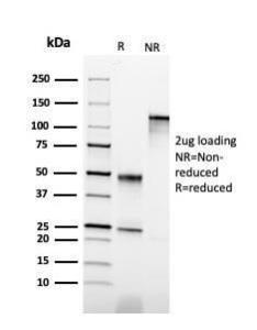 SDS-PAGE analysis of Anti-Cytokeratin 6B Antibody [KRT6B/2116] under non-reduced and reduced conditions; showing intact IgG and intact heavy and light chains, respectively SDS-PAGE analysis confirms the integrity and purity of the antibody