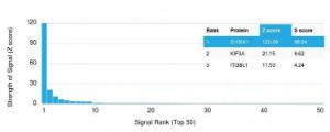 Analysis of protein array containing more than 19,000 full-length human proteins using Anti-S100A1 Antibody [S100A1/1942