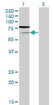 Anti-PGM3 Mouse Monoclonal Antibody [clone: 1E2-1B12]