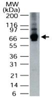 Anti-ALAS1 Rabbit Polyclonal Antibody