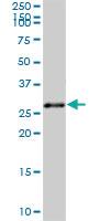 Anti-TOLLIP Mouse Polyclonal Antibody