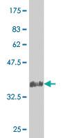 Anti-NEUROG3 Mouse Monoclonal Antibody [clone: 4F9]