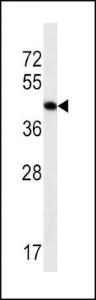 Anti-ACTA1 Mouse Monoclonal Antibody (APC (Allophycocyanin)) [clone: 337CT30.10.1]