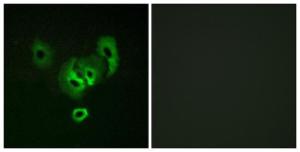 Immunofluorescence analysis of A549 cells using Anti-STEA2 Antibody The right hand panel represents a negative control, where the antibody was pre-incubated with the immunising peptide