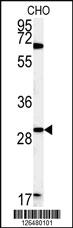 Anti-LHPL2 Rabbit Polyclonal Antibody