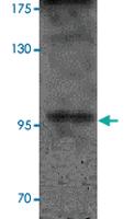 Anti-SIK2 Rabbit Polyclonal Antibody