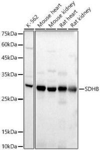 Western blot analysis of extracts of various cell lines, using Anti-SDHB Antibody (A309465) at 1:400 dilution. The secondary antibody was Goat Anti-Rabbit IgG H&L Antibody (HRP) at 1:10,000 dilution.