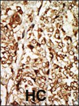 Anti-MOS Rabbit Polyclonal Antibody