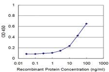 Anti-TOPORS Mouse Monoclonal Antibody [clone: 6D2]