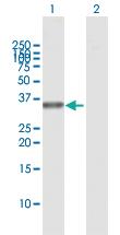 Anti-ALKBH3 Rabbit Polyclonal Antibody