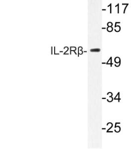 Western blot analysis of lysate from RAW264.7 cells using Anti-IL-2Rbeta Antibody