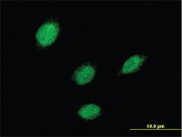 Anti-LHX5 Mouse Monoclonal Antibody [clone: 2A8]