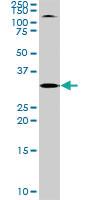 Anti-TOLLIP Rabbit Polyclonal Antibody