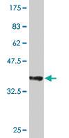 Anti-UBE2D4 Mouse Monoclonal Antibody [clone: 3E1]