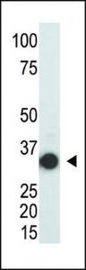 Anti-SULT2A Rabbit Polyclonal Antibody