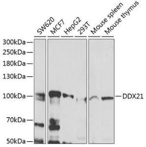 Anti-DDX21 antibody