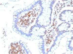 Immunohistochemical analysis of formalin-fixed, paraffin-embedded human colon using Anti-MAPK14 Antibody [CPTC-MAPK14-1]