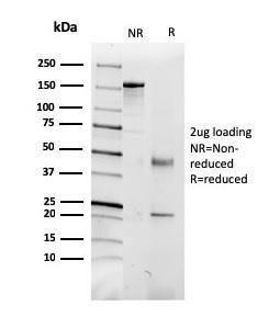 SDS-PAGE analysis of Anti-CD5L Antibody [CD5L/2991] under non-reduced and reduced conditions; showing intact IgG and intact heavy and light chains, respectively. SDS-PAGE analysis confirms the integrity and purity of the antibody.