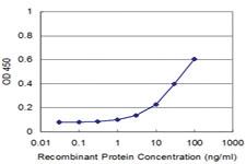 Anti-TOPORS Mouse Monoclonal Antibody [clone: 6C8]