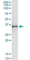 Anti-ALKBH3 Rabbit Polyclonal Antibody