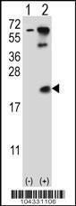 Anti-UBE2B Rabbit Polyclonal Antibody (APC (Allophycocyanin))