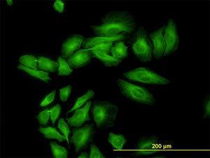 Anti-ENOB Mouse monoclonal antibody [clone: 5D1]