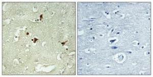 Immunohistochemical analysis of paraffin-embedded human brain using Anti-STAT3 Antibody 1:100 (4°C overnight). The right hand panel represents a negative control, where the antibody was pre-incubated with the immunising peptide