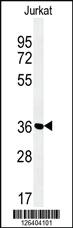 Anti-MFRN2 Rabbit Polyclonal Antibody