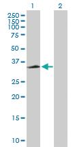 Anti-CXCR2 Mouse Polyclonal Antibody