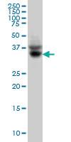 Anti-SLC35A3 Mouse Monoclonal Antibody [clone: 4B6]