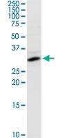 Anti-SULT1E1 Rabbit Polyclonal Antibody