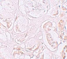 Anti-SLAMF9 Rabbit Polyclonal Antibody