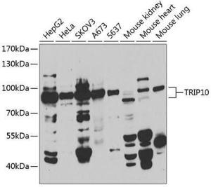 Antibody anti-TRIP10 100 µl