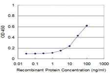 Anti-TOPORS Mouse Monoclonal Antibody [clone: 6F11]