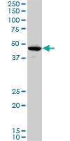 Anti-LHX5 Mouse Monoclonal Antibody [clone: 2B11]