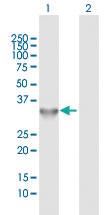 Anti-TOLLIP Rabbit Polyclonal Antibody