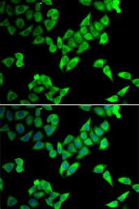 Antibody anti-TRIP10 100 µl