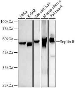 Western blot analysis of extracts of various cell lines, using Anti-Septin 8 Antibody [ARC2988] (A309467) at 1:1,000 dilution