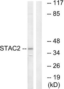 Western blot analysis of lysates from K562 cells using Anti-STAC2 Antibody. The right hand lane represents a negative control, where the antibody is blocked by the immunising peptide