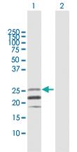 Anti-CD70 Rabbit Polyclonal Antibody